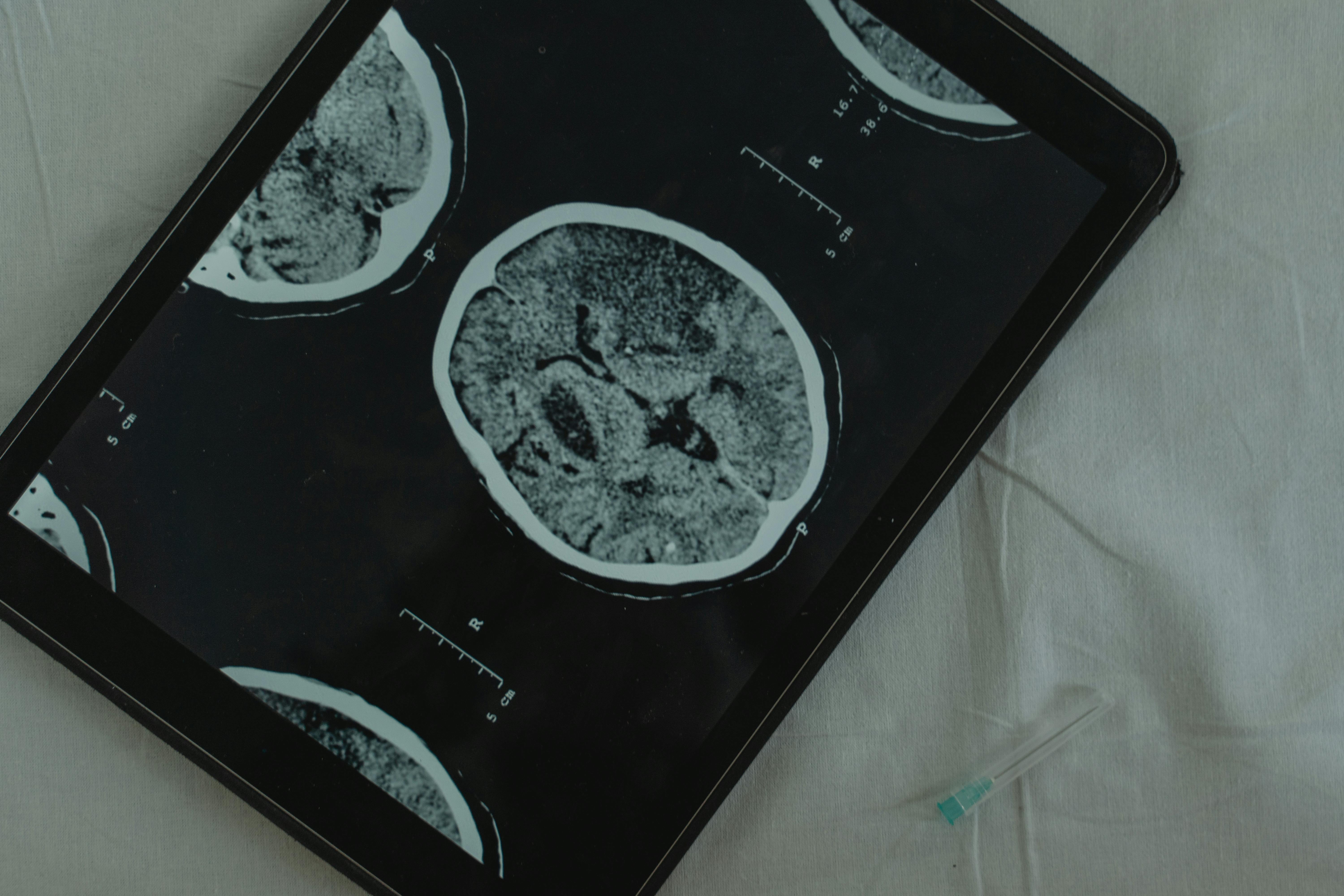¿Qué relación tienen la glándula pineal y el tercer ojo?